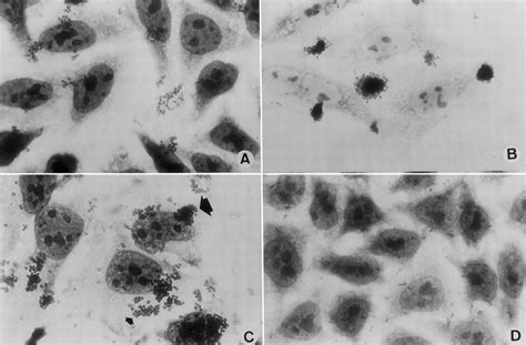 Adherence Patterns In HeLa Cells Presented By Escherichia Coli Strains