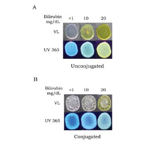 Detection of serum containing elevated levels of bilirubin on various... | Download Scientific ...