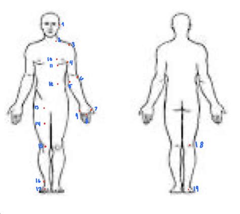 Neuro Exam Flashcards Quizlet