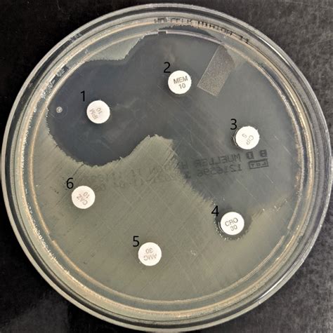 Detektion Von Bakteriellen Antibiotikaresistenzen In Der Medizinischen