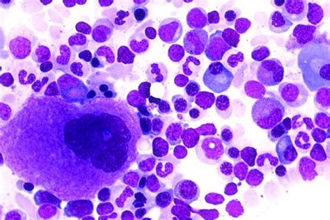 Megakaryocyte In Bone Marrow