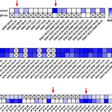 Examples of HLA antibody specificity patterns in paired serum and ... 