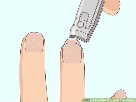 How To Stop Your Nails From Peeling 12 Steps With Pictures