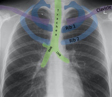 Week 2 Introduction To Cardiorespiratory Imaging Flashcards Quizlet