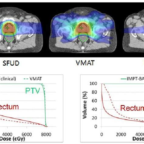 Comparison Of Sfud Vmat And Impt Treatment Plans For One Prostate