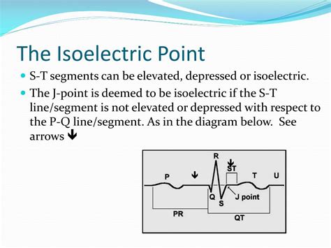 PPT - Advanced ECG Interpretation PowerPoint Presentation, free ...