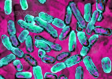 Photograph | Pseudomonas aeruginosa | Science Source Images 