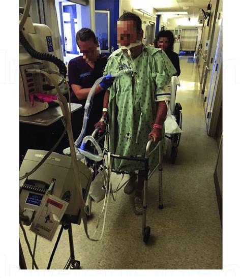 Photo Showing A Patient Receiving Mechanical Ventilation Via An