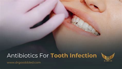 how to make homemade antibiotics for tooth infection