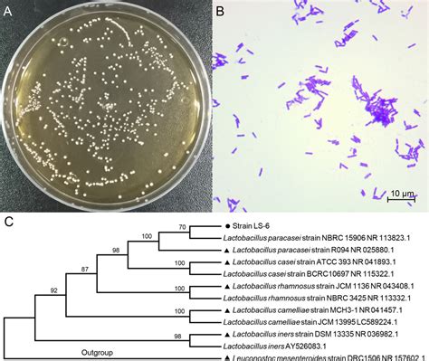 Lactobacillus Plantarum Colony Morphology