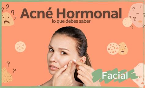 Acné Hormonal Qué Es Cómo Identificarlo Y Tratarlo