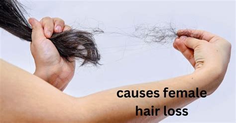 What causes female hair loss?