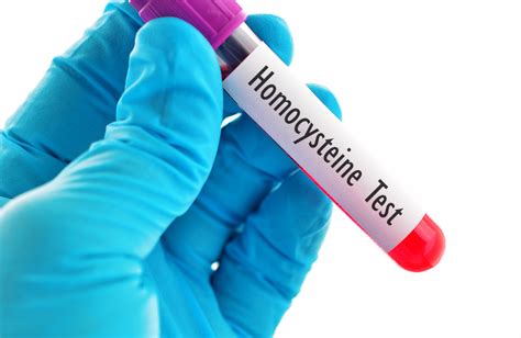 Understanding Homocysteine Test Purpose And Procedure MaxinHealth Blog