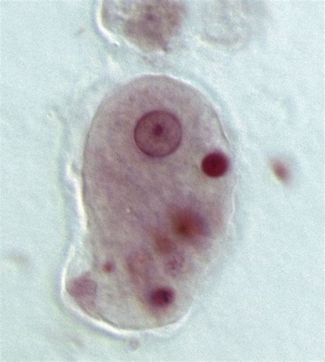 What Is The Difference Between Entamoeba Histolytica And Entamoeba Dispar Compare The