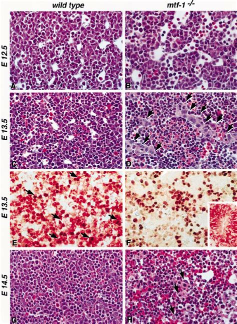 Histological Analysis Of Wild Type And MTF 1 Knockout Embryos Showing