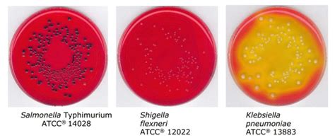 Xld Xylose Lysine Deoxycholate Agar Công Ty Tnhh Thương Mại Và Dịch Vụ Xuất Nhập Khẩu Thành Mỹ