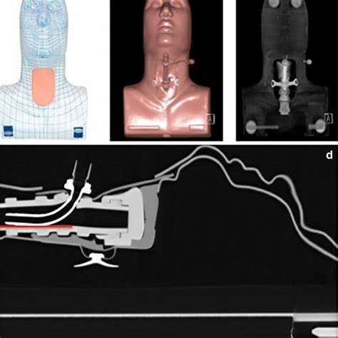 Tracheostomy Training Manikin Used For The Study Smiths Medical A