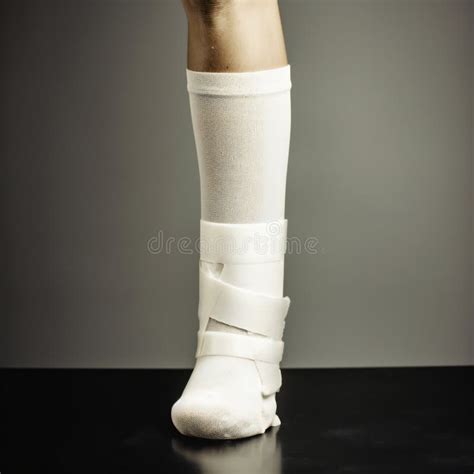 Broken Leg. Leg in a Cast or Plaster on Isolated Background. Generative Ai Stock Illustration ...