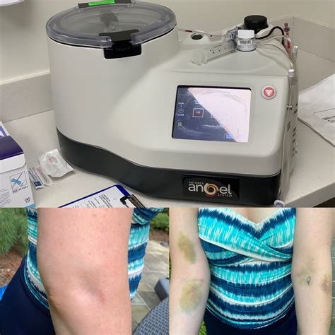 PRP.... - Susan Onysko Photography