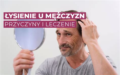 Łysienie u mężczyzn przyczyny rodzaje leczenie Biomedika