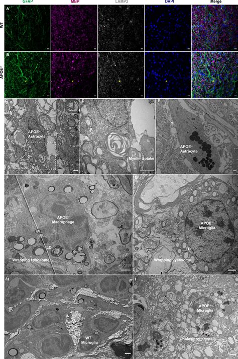 Frontiers Bioinformatics Analysis Identified Apolipoprotein E As A