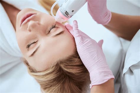 Radiofrequenz Microneedling Berlin Potsdam Aknenarben Entfernen