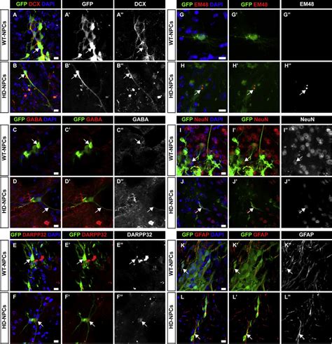 Characterization Of Neuron Differentiation In Grafted Npcs A And B