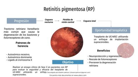 Aplicacion De Celula MADRE RETINITIS PIGMENTOISA Pdf