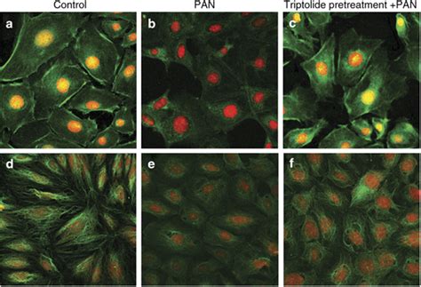 Triptolide Reversed PAN Induced Podocytes Actin Cytoskeleton