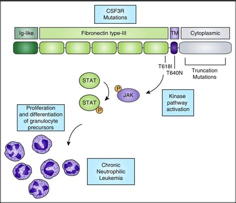 Genomics Of Chronic Neutrophilic Leukemia PMC