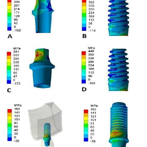 Maximum Principal Stress In Implants And Abutments A And B Ti Ti Download Scientific Diagram