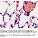 Light Micrograph of the Parenchyma of the Lung