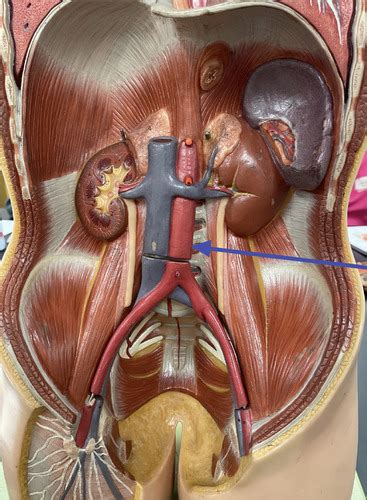 Bio 202 Lab Practical 2 Arteries And Veins Of The Abdomen And Pelvic