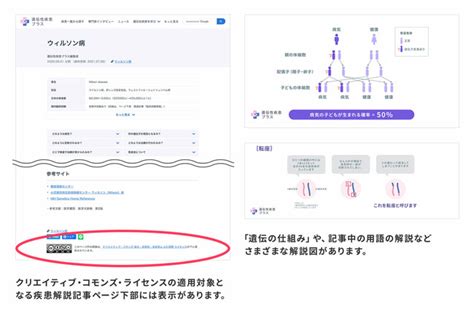 遺伝性疾患プラス、「病気の解説図」の二次利用が可能に 2021年7月9日 エキサイトニュース