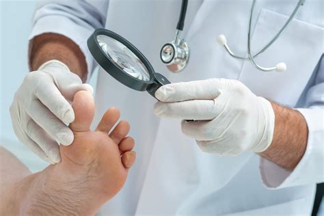 Hallux Limitus S Ntomas Causas Y Tratamientos Para La Limitaci N De