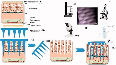 Microneedles Assisted Controlled And Improved Transdermal Delivery Of