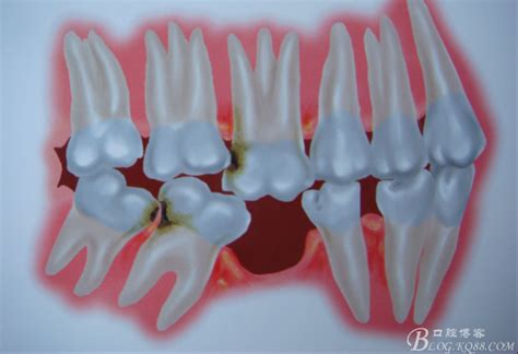 儿童口腔保健知识大全 爱齿尔徐廷国的博客 KQ88口腔博客