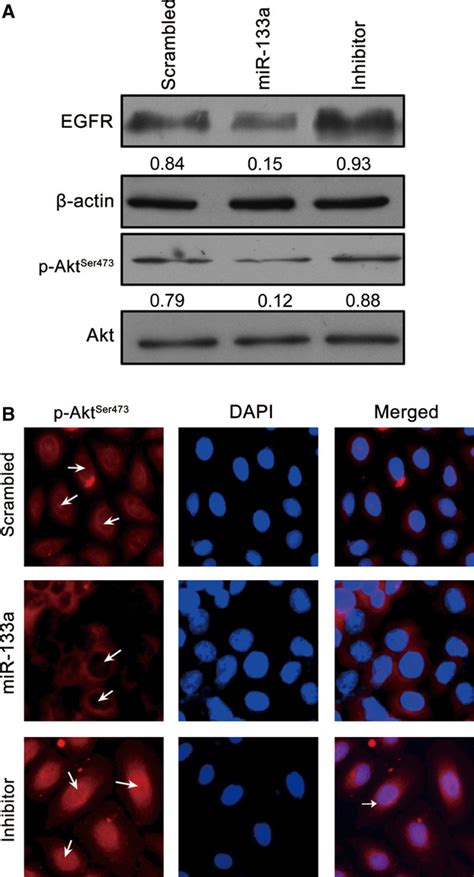 Microrna‐133a Regulates The Cell Cycle And Proliferation Of Breast