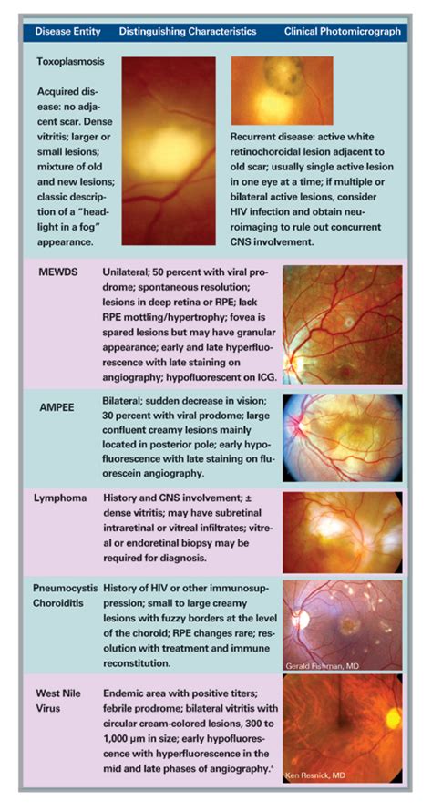 Multifocal Choroiditis vs. PIC: Variations on a Theme?