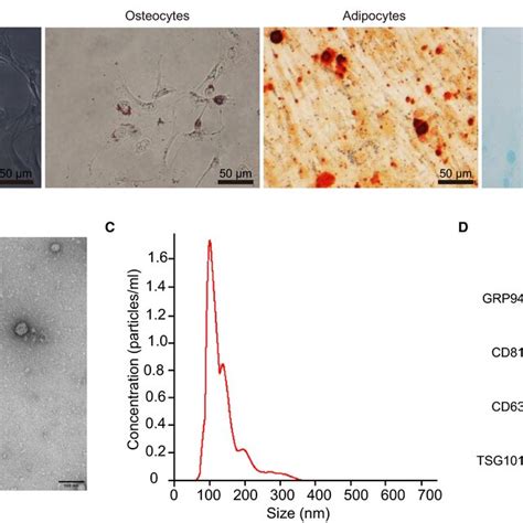 Identification Of Admscs And Evs A The Morphology Of The Third Download Scientific Diagram