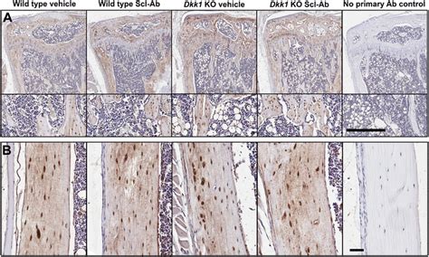 Immunohistochemistry For Sclerostin In Tibiae Of Vehicle And