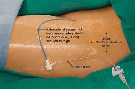 Diagram Of Male Groin Area Illustration Of The Human Groin Anatomy