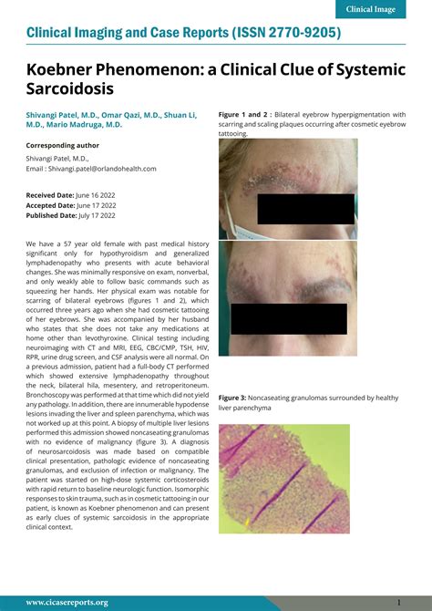 Koebner Phenomenon A Clinical Clue Of Systemic Sarcoidosis By Clinical Imaging And Case Reports