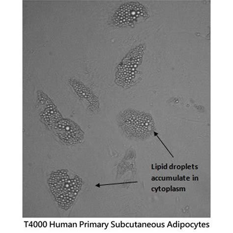 Get T4000 Human Primary Subcutaneous Adipocytes From MBP INC