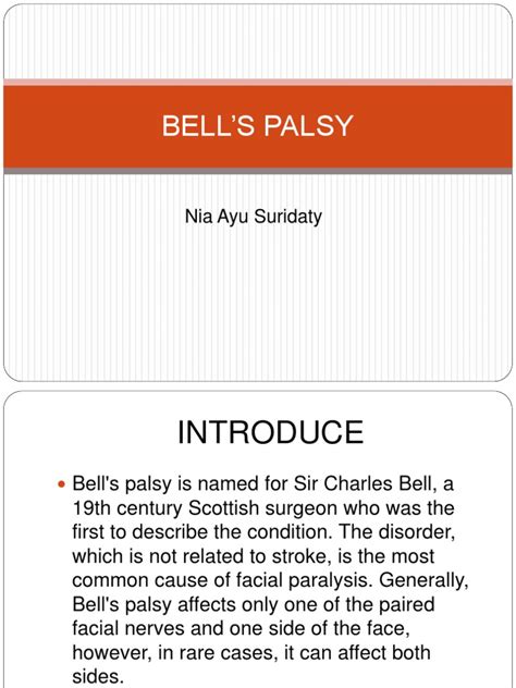 Bells Palsy Ppt Diseases And Disorders Clinical Medicine