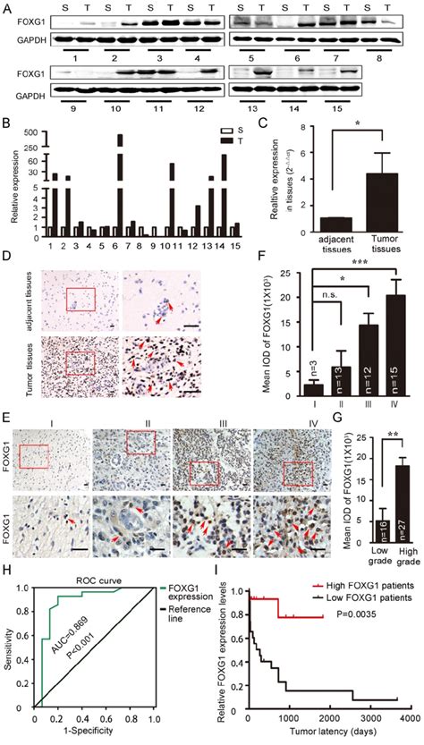 Foxg1 Expression Elevated In Gliomas A Western Blotting Analyses Of Download Scientific