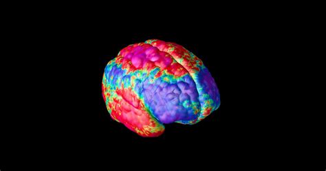 Mapping How Schizophrenia Changes Brains Pursuit By The University Of