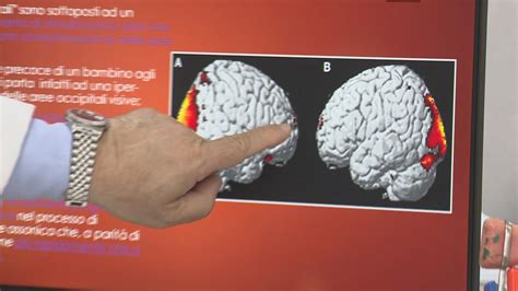 Tablet E Cellulari Nei Bambini Cambiano Lo Sviluppo Del Cervello