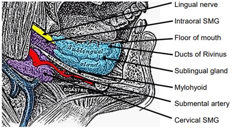 Escisi N De Ranula Y Gl Ndula Salival Sublingual Libretexts Espa Ol