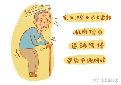 帕金森病帕金森综合征？答案是 知乎